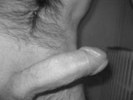 Photo de complicedegliss